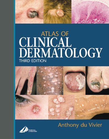 Stock image for Atlas of Clinical Dermatology for sale by Book Deals