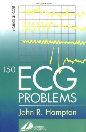 Beispielbild fr 150 ECG Problems zum Verkauf von Better World Books