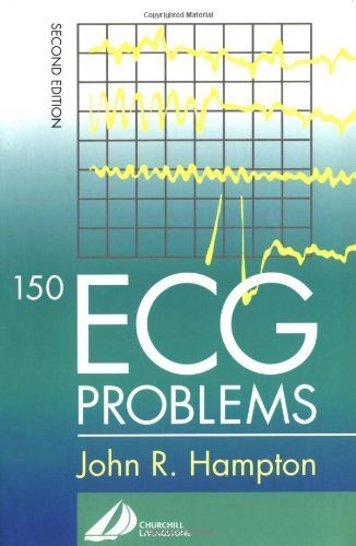 Imagen de archivo de 150 ECG Problems a la venta por Brit Books