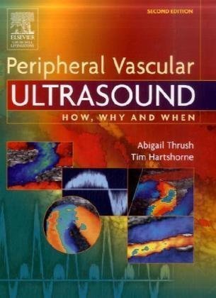 Beispielbild fr Peripheral Vascular Ultrasound: How, Why and When zum Verkauf von Decluttr