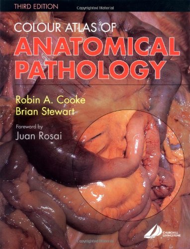 Beispielbild fr Colour Atlas of Anatomical Pathology zum Verkauf von Better World Books