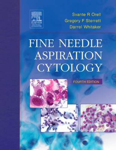Imagen de archivo de Fine Needle Aspiration Cytology a la venta por Wonder Book