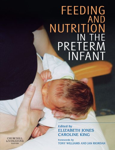 Imagen de archivo de Feeding and Nutrition in the Preterm Infant a la venta por Irish Booksellers