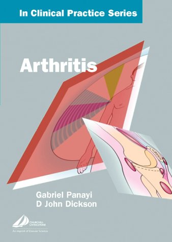 Beispielbild fr Churchill's In Clinical Practice Series: Arthritis zum Verkauf von WorldofBooks