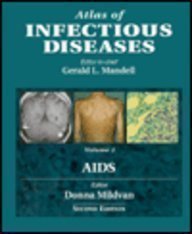 Imagen de archivo de Atlas of Infectious Disease, Volume 1: AIDS a la venta por The Book Exchange