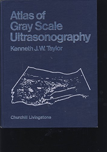 Atlas of Gray Scale Ultrasonography