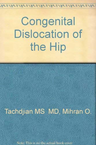 Imagen de archivo de Congenital Dislocation of the Hip a la venta por GridFreed