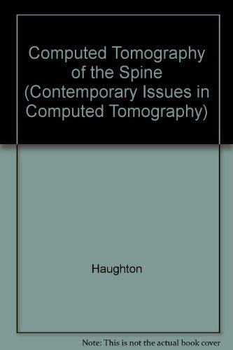 Stock image for Computed Tomography of the Spine for sale by Better World Books