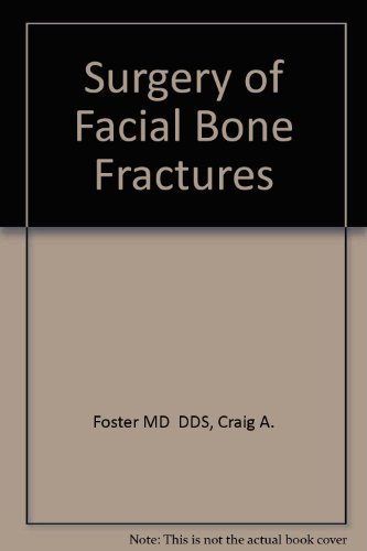 Stock image for Surgery of Facial Bone Fractures for sale by HPB-Red