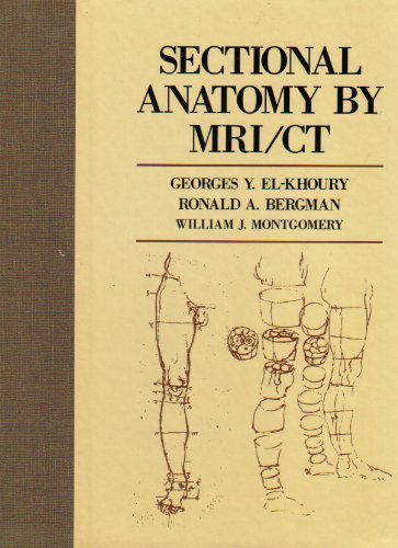 Beispielbild fr Sectional Anatomy by MRI - CT zum Verkauf von Better World Books Ltd