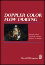 Beispielbild fr Doppler Color Flow Imaging zum Verkauf von Wonder Book