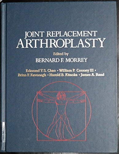 9780443087257: Joint Replacement Arthroplasty