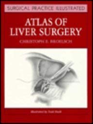 9780443087332: Atlas of Liver Surgery