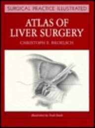 Stock image for Atlas of Liver Surgery (Surgical Practice Illustrated) for sale by HPB-Red