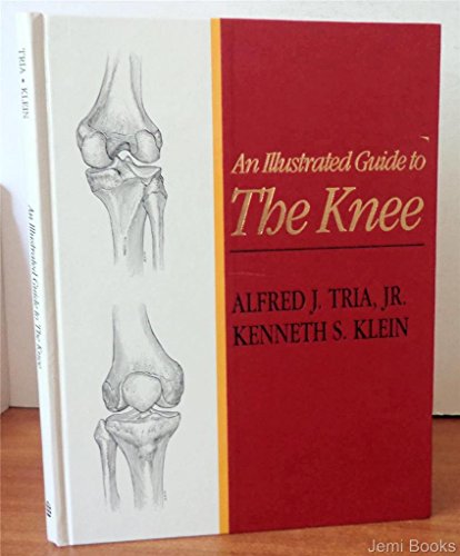 Illustrated Guide to The Knee