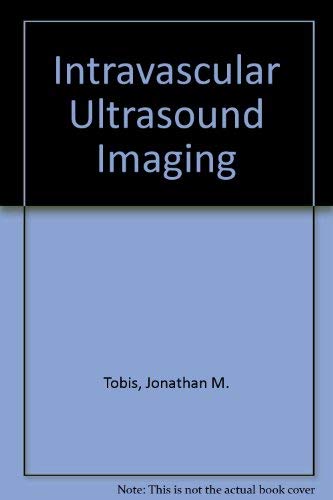 Intravascular Ultrasound Imaging