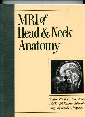 MRI of Head and Neck Anatomy