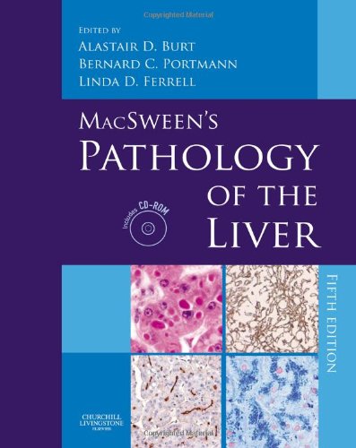 Stock image for MacSweens Pathology of the Liver: with CD-ROM for sale by Solr Books