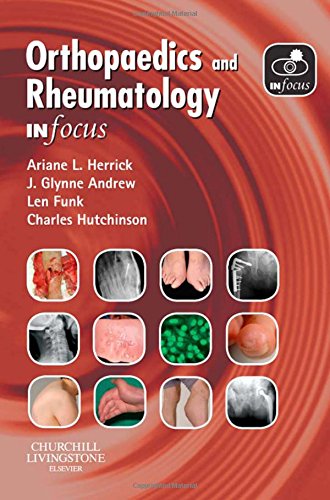 Imagen de archivo de Orthopaedics and Rheumatology In Focus a la venta por Book Deals