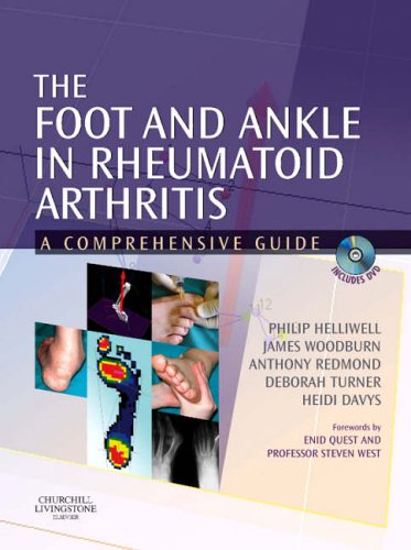 Beispielbild fr The Foot and Ankle in Rheumatoid Arthritis : A Comprehensive Guide zum Verkauf von Better World Books Ltd