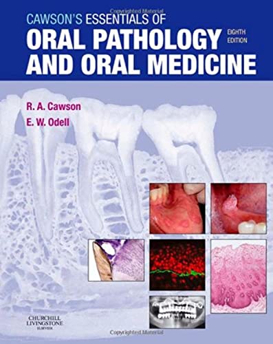 Stock image for Cawsons Essentials of Oral Pathology and Oral Medicine for sale by Zoom Books Company