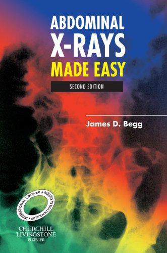 9780443102561: Abdominal X-Rays Made Easy, International Edition, Second Edition