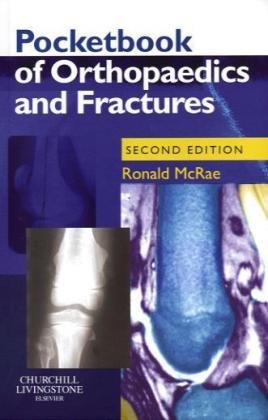 Imagen de archivo de Pocketbook of Orthopaedics and Fractures a la venta por Mr. Bookman