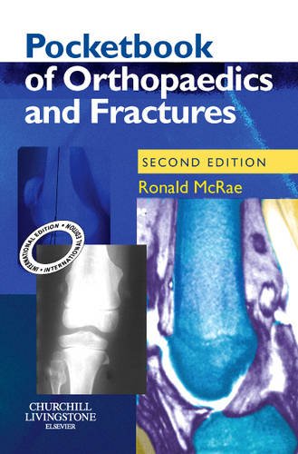 Stock image for Pocketbook of Orthopaedics and Fractures for sale by Better World Books