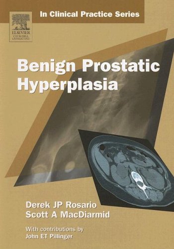 Imagen de archivo de Benign Prostatic Hyperplasia a la venta por Books Puddle