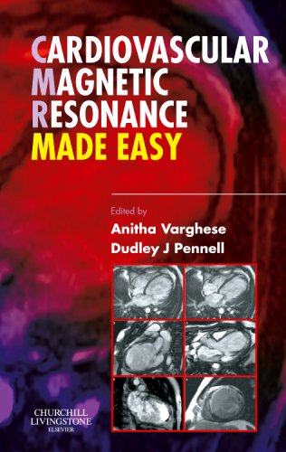 Imagen de archivo de Cardiovascular Magnetic Resonance Made Easy a la venta por Anybook.com
