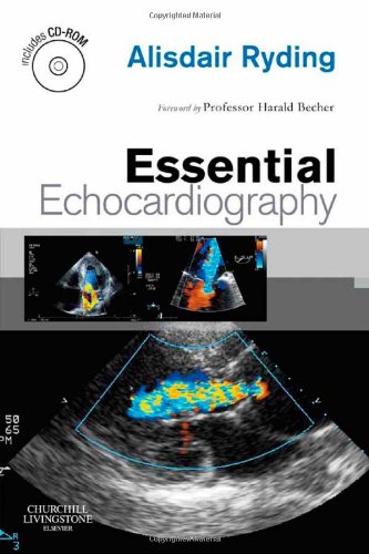 Stock image for Essential Echocardiography for sale by HPB-Red