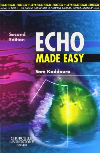 9780443103643: Echo Made Easy International Edition