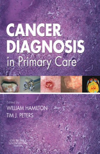 Imagen de archivo de Cancer Diagnosis in Primary Care a la venta por Better World Books: West