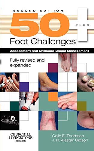 Imagen de archivo de 50+ Foot Challenges: Assessment and Evidence-based Management a la venta por Revaluation Books