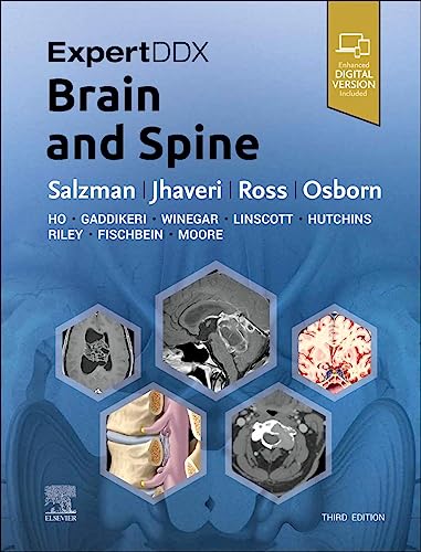 Beispielbild fr ExpertDDx: Brain and Spine zum Verkauf von PBShop.store UK