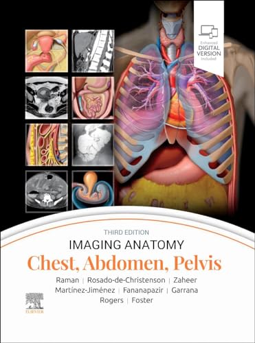 Stock image for Imaging Anatomy: Chest, Abdomen, Pelvis for sale by Revaluation Books
