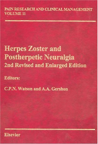 Beispielbild fr Herpes Zoster: Pain Research And Clinical Managemnet Series, Volume 11 (Volume 11) (Pain Research And Clinical Management, Volume 11) zum Verkauf von Tacoma Book Center