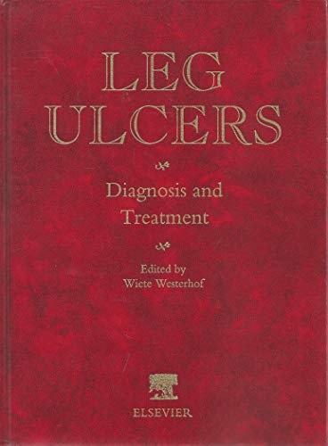 LegUlcers: Diagnosis and Treatment