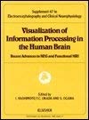 Stock image for Visualization of Information Processing in the Human Brain: Recent Advances in MEG and Functional MRI [Electroencephalography and Clinical Neurophysiology, Supplement No. 47] for sale by Tiber Books