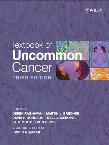 9780470012024: Textbook of Uncommon Cancer.: Third edition