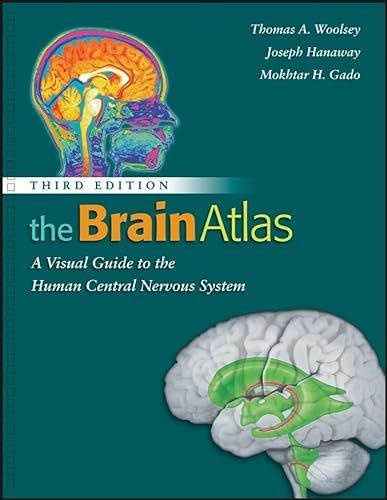 Stock image for The Brain Atlas: A Visual Guide to the Human Central Nervous System Woolsey, Thomas A.; Hanaway, Joseph and Gado, Mokhtar H. for sale by Aragon Books Canada