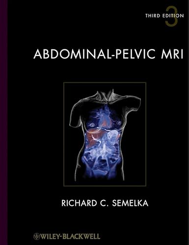 9780470487754: Abdominal-pelvic MRI