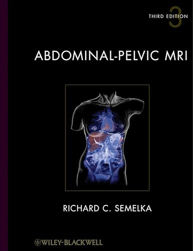 Stock image for Abdominal-Pelvic MRI, 2 Volume Set for sale by dsmbooks