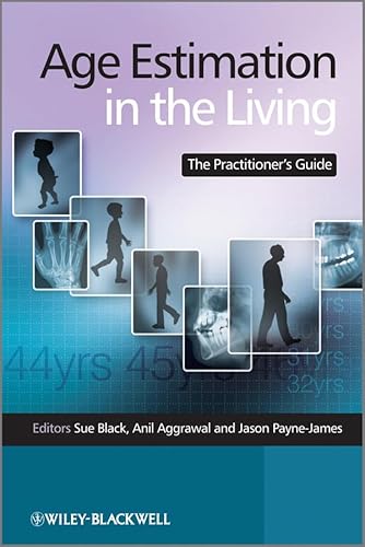Stock image for Age Estimation in the Living : The Practitioner's Guide for sale by Better World Books Ltd