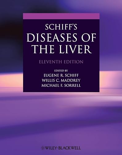 9780470654682: Schiff's Diseases of the Liver + website