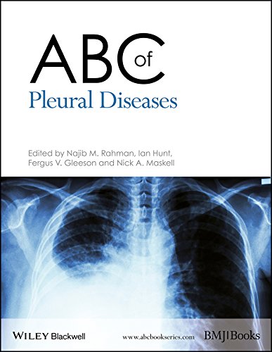 Imagen de archivo de ABC of Pleural Diseases a la venta por Blackwell's