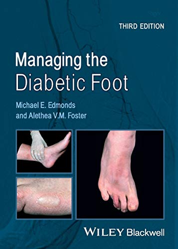 Beispielbild fr Managing the Diabetic Foot zum Verkauf von Buchmarie