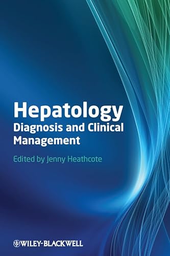 Beispielbild fr Hepatology: Diagnosis and Clinical Management zum Verkauf von HPB-Red