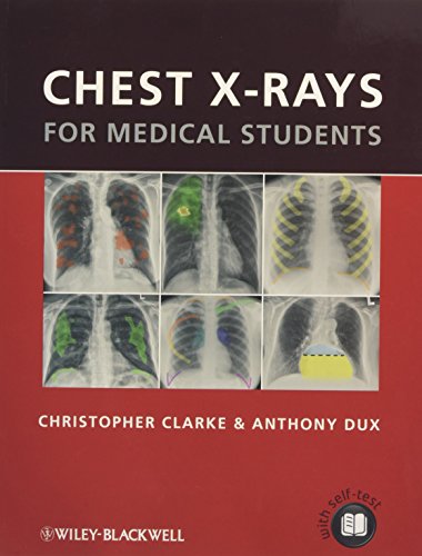 Imagen de archivo de Chest X-rays for Medical Students a la venta por BookHolders