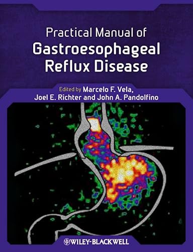 Imagen de archivo de Practical Manual of Gastroesophageal Reflux Disease Format: Paperback a la venta por INDOO